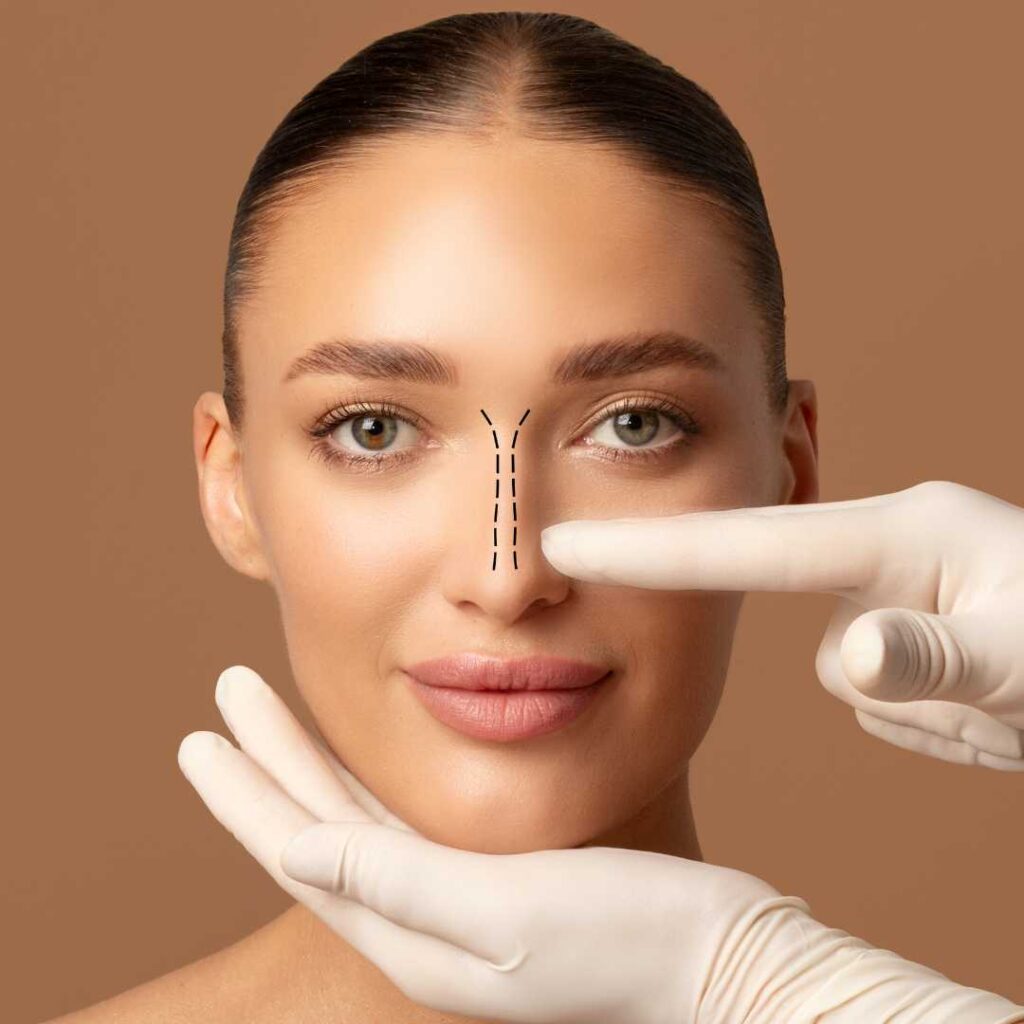 rhinoplasty dr. Heri Noviana Sp.BP-RE, M. Ked Klin.