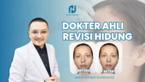 dokter revisi hidung