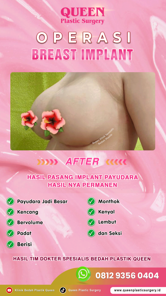 Apakah implan payudara bisa pecah? Apakah mengganggu menyusui? ❌ Berhenti menebak-nebak! Kami merangkum fakta medis terkini tentang teknologi implan yang aman dan tahan lama. 💎
Dapatkan informasi akurat agar Anda bisa melangkah dengan percaya diri.
🔗 Klik link di bio untuk baca artikel!
Diskusi lebih lanjut? Jadwalkan janji temu dengan dr. Heri Noviana, SpBP-RE, M.Ked.Klin.