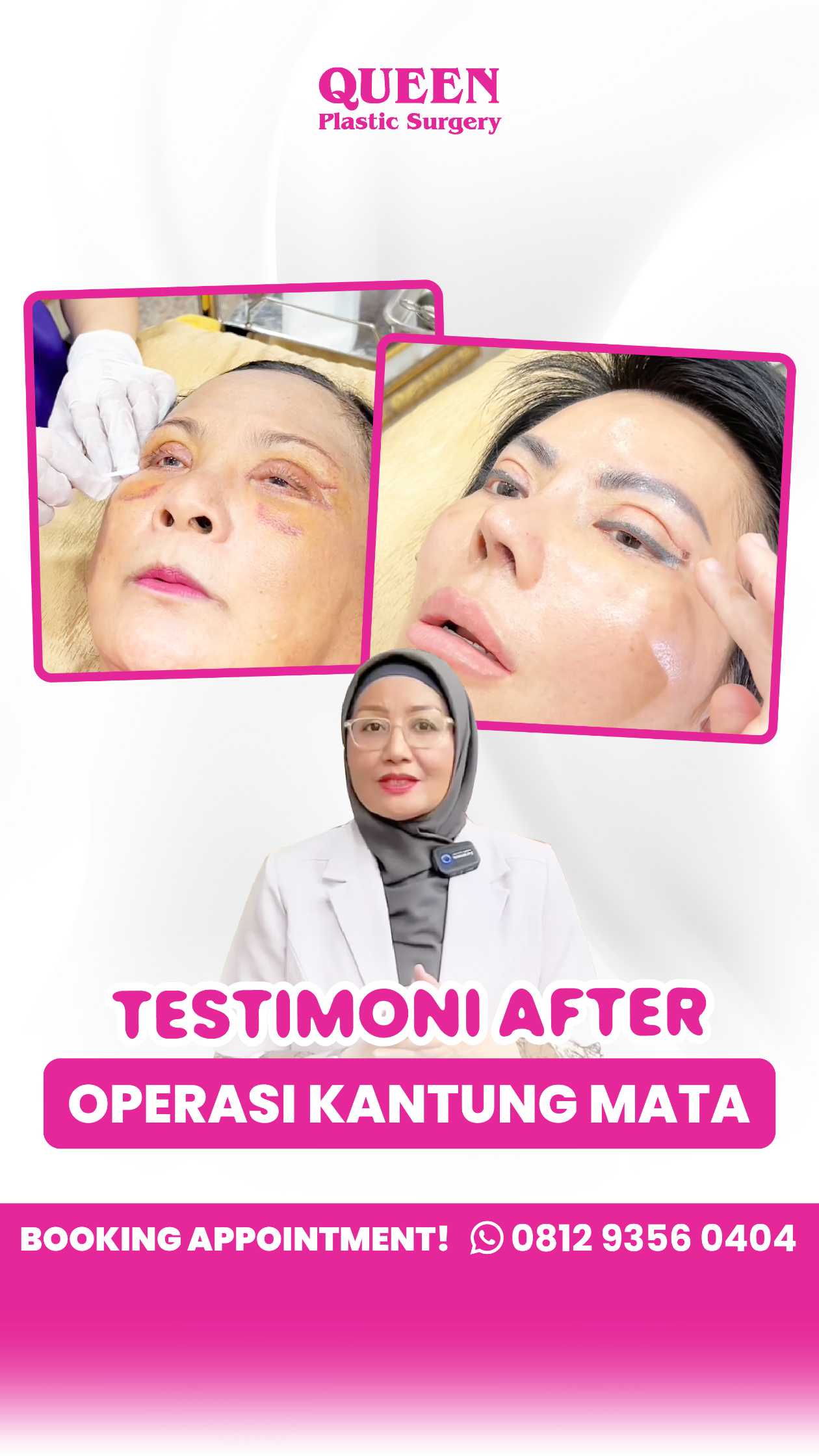 Mata kencang, wajah auto segar! 💎 Simak bedanya Blefaroplasti dan Brow Lift agar tidak salah pilih prosedur.