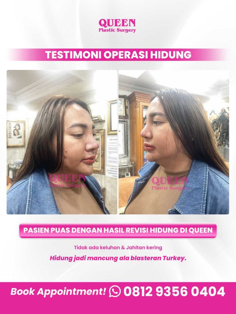 Operasi berjalan lancar, sekarang waktunya 'aftercare' maksimal. Pastikan tubuh Anda mendapat asupan terbaik agar hasil bedah estetika makin mempesona.
Baca panduan dr. Heri Noviana, SpBP-RE.M.Ked.Klin dan mulai konsultasi Anda!