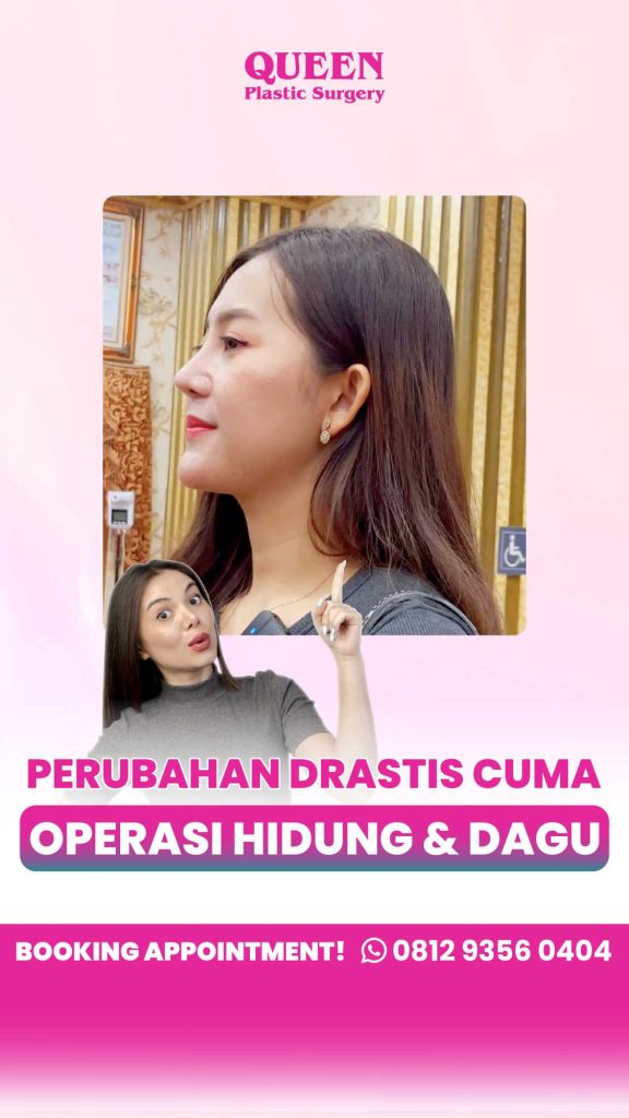 Implan vs Tulang Rawan: Mana yang lebih awet seumur hidup? 👃 Simak kupas tuntas bedah plastik augmentasi rhinoplasty bersama dr. Heri Noviana, SpBP-RE.M.Ked.Klin sebelum kamu booking jadwal!
👉 Cek artikel lengkapnya di sini