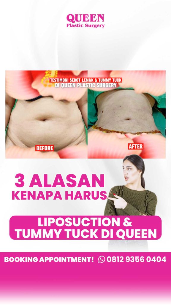 Ingin bentuk tubuh kembali ideal dengan aman? Mommy Makeover adalah solusinya. Ditangani langsung oleh ahli bedah plastik berpengalaman, dr. Heri Noviana, SpBP-RE, M.Ked.Klin, hasil natural bukan lagi impian.
Daftar konsultasi sekarang! ⬇️