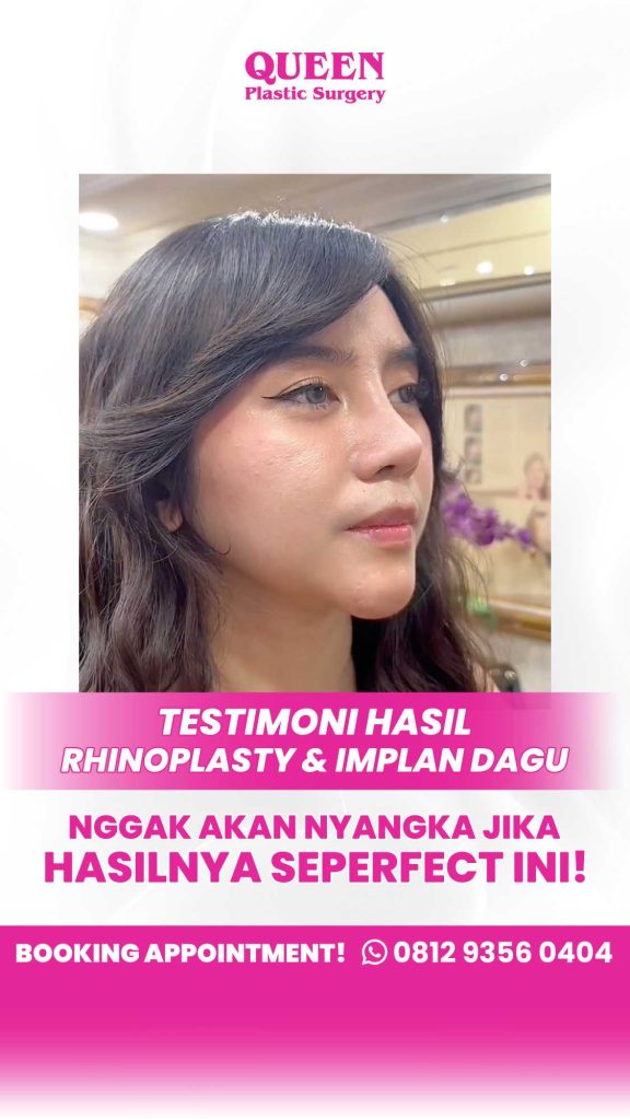 Pulih lebih cepat, kembali beraktivitas lebih singkat! 🚀 Jangan sembarang minum vitamin pasca bedah estetika. Cek rahasia pemulihan optimal bersama dr. Heri Noviana, SpBP-RE.M.Ked.Klin
Klik untuk rahasia pulih cepatmu!