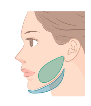 Bye-bye pipi chubby dan double chin! Ternyata rahasia wajah tirus bukan cuma soal diet. Simak panduan lengkap operasi pengangkatan lemak pipi di artikel terbaru kami.
👉 Cek detail prosedurnya di sini!
