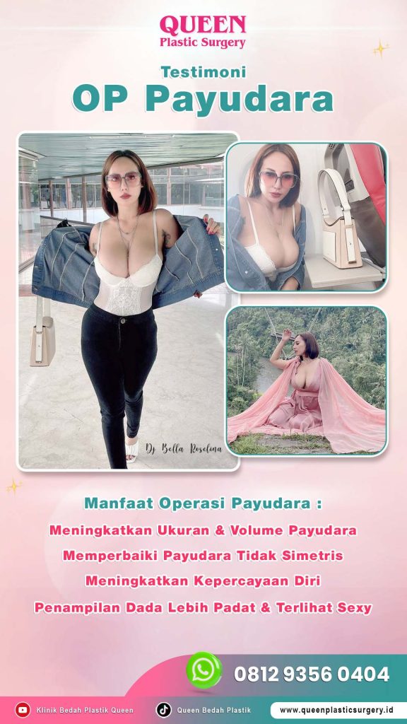 Transformasi pasca-melahirkan memerlukan pendekatan medis yang presisi. Artikel terbaru kami membahas tuntas prosedur Mommy Makeover bersama pakar bedah plastik dr. Heri Noviana, SpBP-RE, M.Ked.Klin.

Temukan bagaimana teknologi bedah plastik terkini dapat membantu Anda meraih kembali siluet tubuh sebelum hamil.
