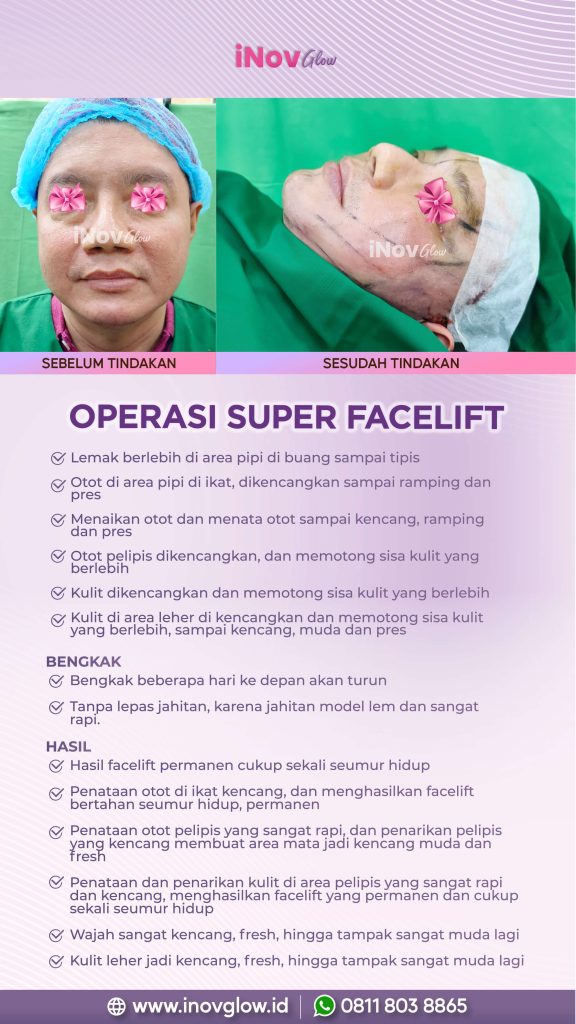 Punya keluhan pasca-operasi facelift? Garis wajah tampak tidak simetris atau bekas luka terlalu menonjol? Waspadai tandanya dan cari tahu cara mengatasinya secara medis.
Baca selengkapnya dan konsultasikan dengan dr. Heri Noviana, SpBP-RE.M.Ked.Klin di sini!