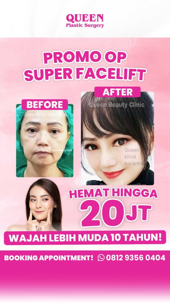 Ucapkan selamat tinggal pada pipi kendur! 👸 Temukan cara medis mengembalikan V-Shape wajah di usia 60-an dengan memilih jenis facelift. Tanya dr. Heri Noviana, SpBP-RE.M.Ked.Klin yuk!