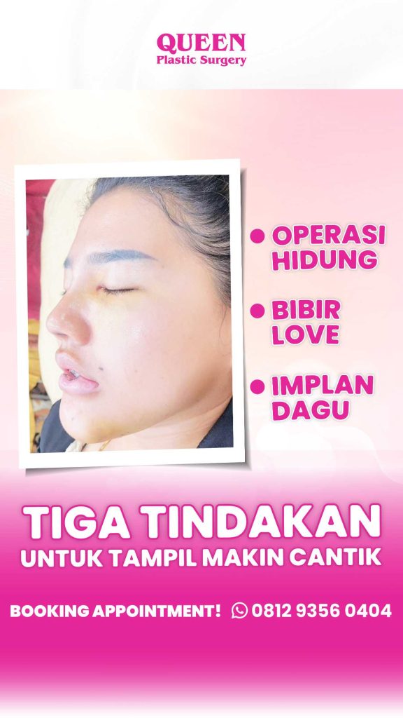 Pastikan masa pemulihan Anda berjalan aman dan bebas komplikasi. Konsultasikan nutrisi Anda dengan dr. Heri Noviana, SpBP-RE.M.Ked.Klin.
👉 Simak tips lengkapnya di blog kami!