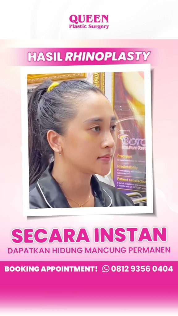 Optimalkan proses recovery Anda dengan diet yang tepat. Inilah panduan nutrisi pasca operasi plastik yang wajib Anda tahu!
👉 Baca artikel lengkapnya di sini