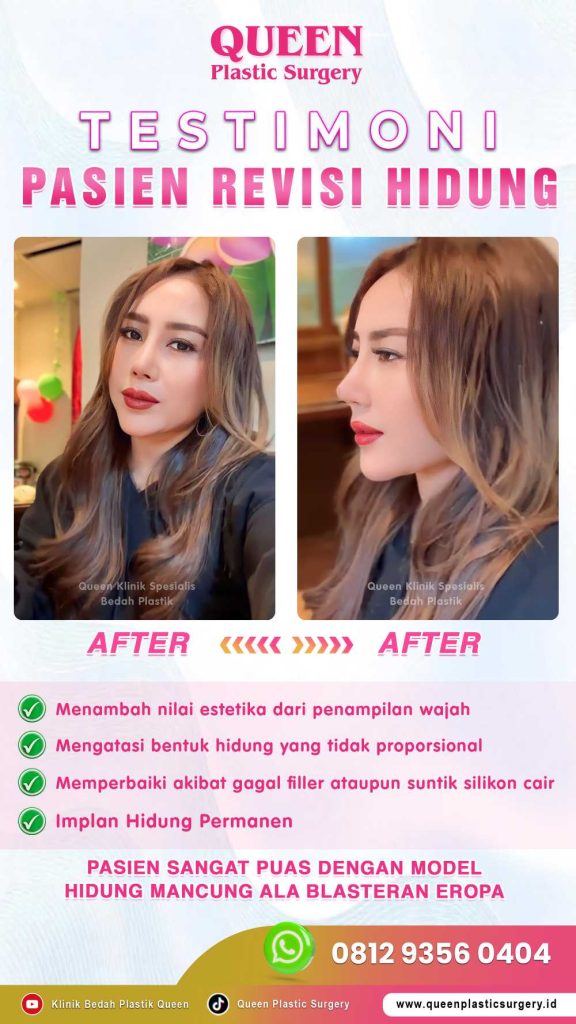 Wajah lebih simetris dengan Rhinoplasty? Mengapa tidak! Temukan rahasia tampilan wajah harmonis bersama dr. Heri Noviana, SpBP-RE.M.Ked.Klin.
📱 Hubungi kami untuk info lebih lanjut!