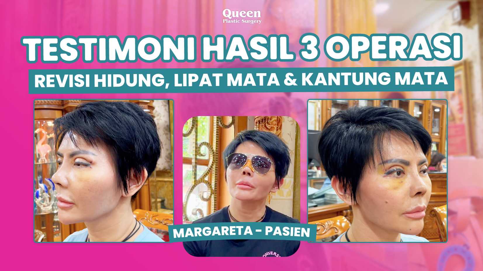 Facelift bisa kencangkan kelopak mata kendur? 🤔 Jangan sampai salah kaprah! Cek faktanya di sini sebelum konsultasi dengan dr. Heri Noviana, SpBP-RE.M.Ked.Klin.