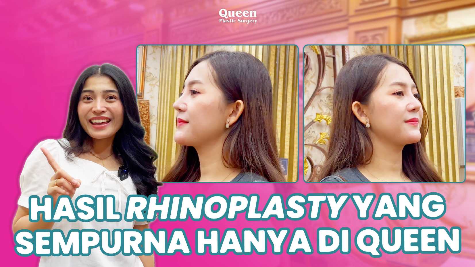 Wajah simetris bukan sekadar impian. Dengan teknik Rhinoplasty yang tepat, Anda bisa tampil lebih percaya diri dari setiap sudut (angle). Pelajari prosedurnya langsung dari pakarnya, dr. Heri Noviana, SpBP-RE.M.Ked.Klin.
✨ Cek jadwal konsultasi di sini!