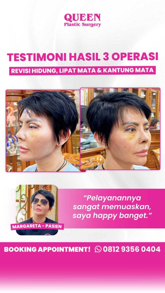 Ingin area mata lebih kencang? Simak kupas tuntas Blefaroplasti vs Brow Lift bersama ahlinya, dr. Heri Noviana, SpBP-RE.M.Ked.Klin.