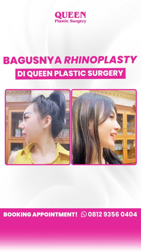 Tidur Lebih Nyenyak Tanpa Suara Mendengkur! 🌙
Dengkur berlebih bisa jadi tanda masalah pada struktur hidung. Kenali solusinya melalui prosedur medis yang aman dan profesional dari ahlinya. Konsultasikan kondisi Anda dengan dr. Heri Noviana, SpBP-RE, M.Ked.Klin sekarang.
🔗 Cek info lengkapnya di sini