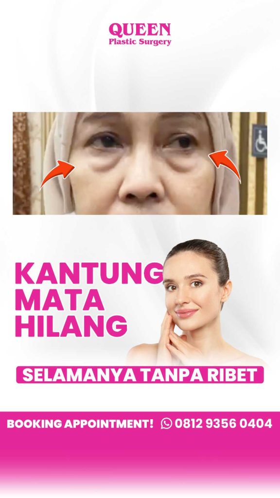 Botox vs Blefaroplasti: Mana rahasia mata awet muda yang paling pas buat kamu? Jangan sampai salah pilih!