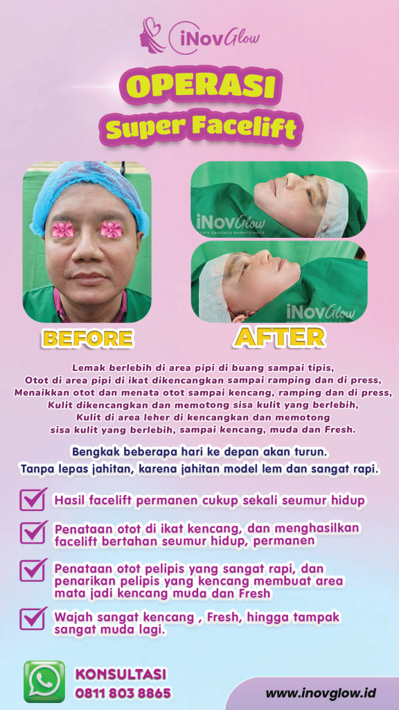 Tujuan facelift adalah tampil lebih muda, bukan tampil "berbeda". Jika hasilnya terlihat tidak alami, saatnya mencari opini kedua dari ahlinya.
Atur janji temu dengan dr. Heri Noviana, SpBP-RE.M.Ked.Klin melalui WhatsApp kami.