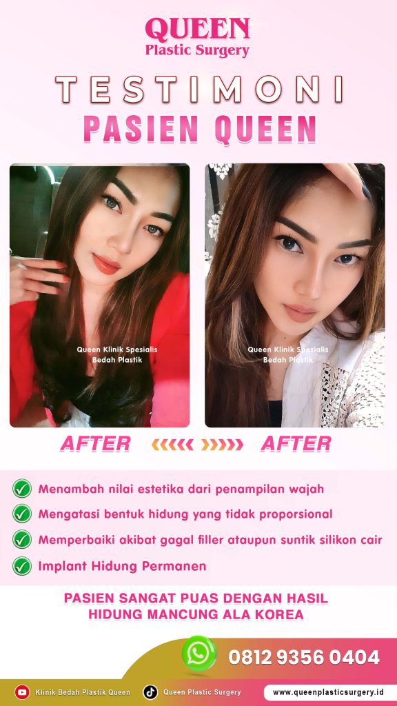 Satu rahasia pemulihan operasi plastik yang sering diabaikan: Berhenti merokok! 🛑 Simak ulasan lengkapnya dari Dr. Heri Noviana.