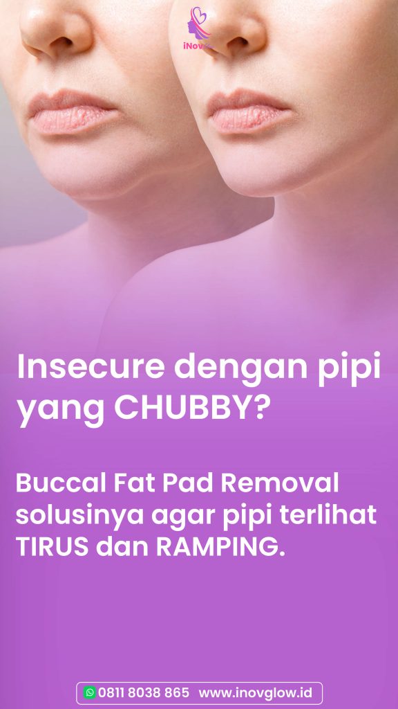 Rahasia rahang tajam dan wajah ramping terungkap! 🔍 Cek panduan Sedot Lemak Pipi di artikel terbaru kami. Tanya dr. Heri Noviana yuk!