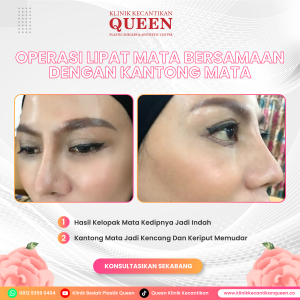 Satu prosedur saja tidak cukup? 🤔 Cari tahu kenapa menggabungkan facelift dan blefaroplasti bisa bikin wajahmu 15 tahun lebih muda!