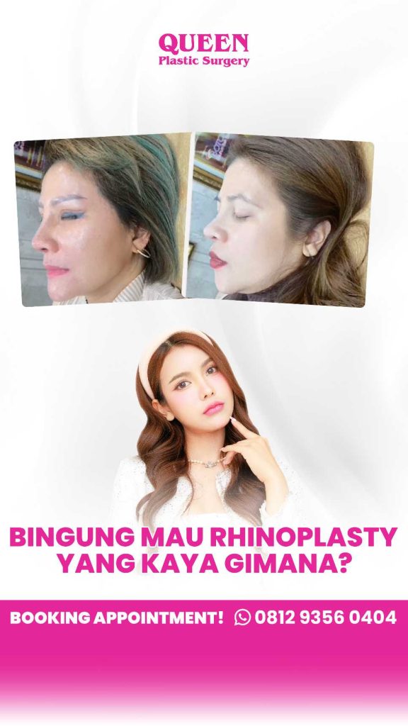 Jangan asal pasang! ⚠️ Kenali bahan Rhinoplasty yang paling tahan lama seumur hidup. Konsultasi langsung dengan dr. Heri Noviana.