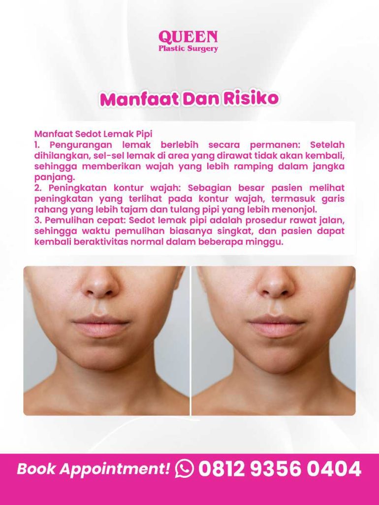 Wajah tirus tanpa editan? Bisa banget! โ๏ธ Cek caranya di artikel sedot lemak pipi bareng dr. Heri Noviana.