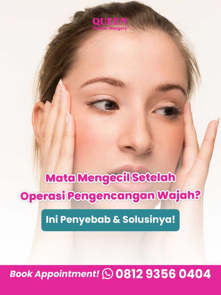 Jangan biarkan hasil operasi pengencangan wajah bikin kamu stres! 🧘 Pelajari penyebab mata mengecil & bagaimana cara menanganinya secara medis.