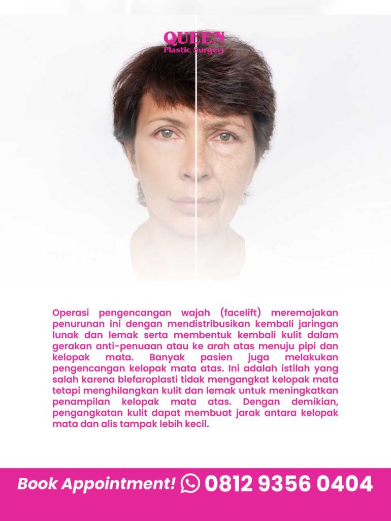 Solusi jitu atasi mata yang tampak mengecil setelah pengencangan wajah. 💡 Simak panduan pemulihannya di sini!