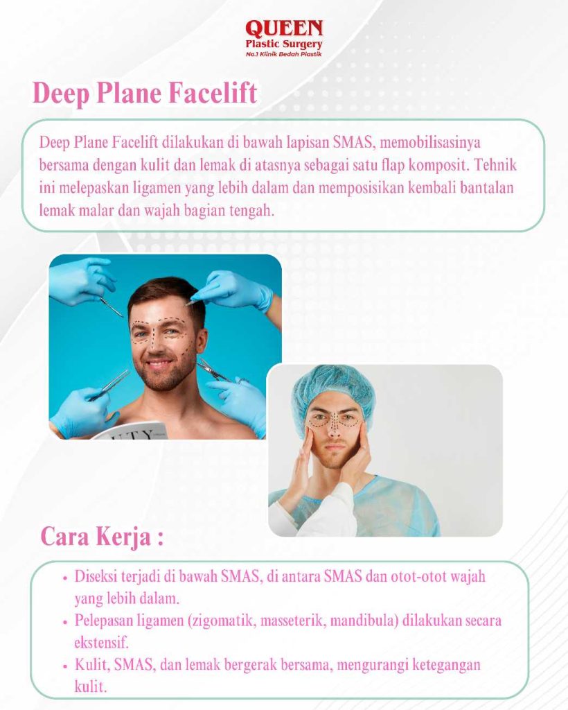 Mau hasil yang paling natural atau yang paling tahan lama? 💎 Bandingkan Facelift SMAS vs Deep Plane Facelift di sini!