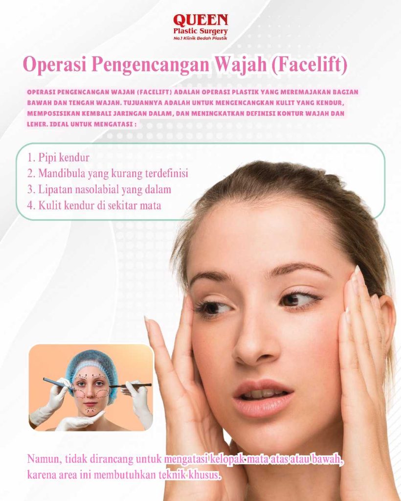Banyak yang salah sangka! Apakah Facelift otomatis memperbaiki kelopak mata kendur? 🧐 Cari tahu jawabannya sebelum Anda ambil tindakan!
