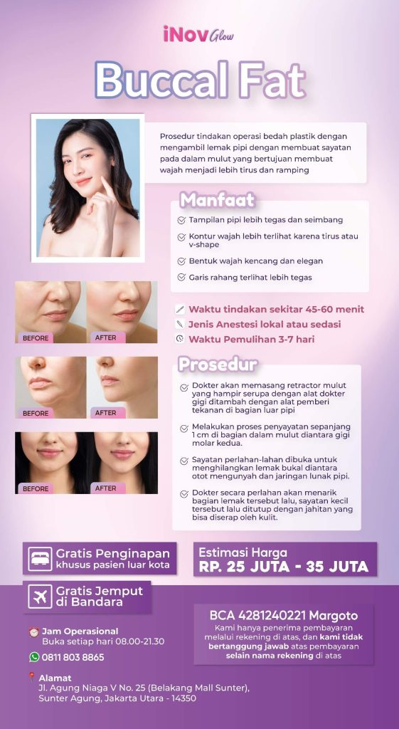 Kenapa wajah V-Shape kini jadi standar kecantikan modern? 📈 Cek bagaimana Sedot Lemak Pipi mengubah profil wajahmu di sini!