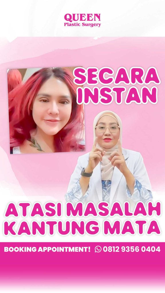 Banyak yang tidak tahu! Kantung mata bisa muncul kembali karena faktor ini. 📉 Konsultasikan solusi perbaikannya dengan dr. Heri Noviana, Sp.BP-RE, M.Ked.Klin