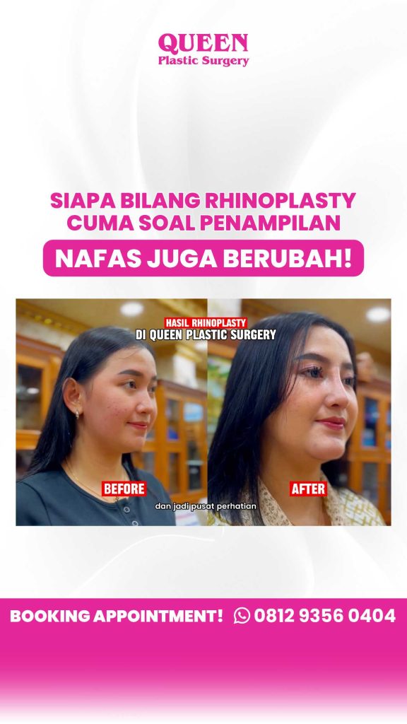 Takut bentuk hidung berubah atau amblas di tengah jalan selama pemulihan? 😰 Tenang, cek fakta penstabilan jaringan bersama Dr. Heri Noviana.