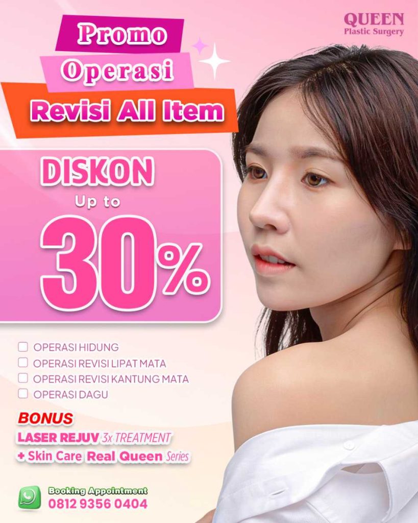 Facelift Natural Diskon Hingga 25% di Queen Plastic Surgery
