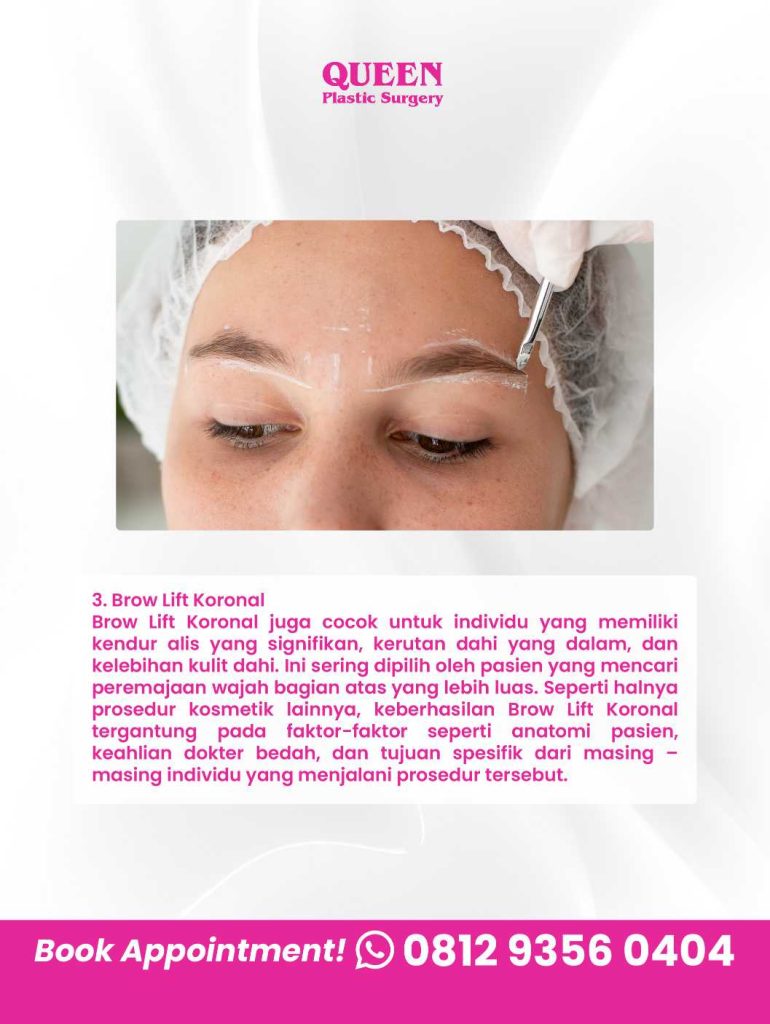 Mau hasil alis naik yang bertahan lama tapi minim downtime? 🧏♀️ Simak ulasan klinis Endoskopi vs Direct Brow Lift dari Dr. Heri Noviana, SpBP-Re, M. Ked. Klin.