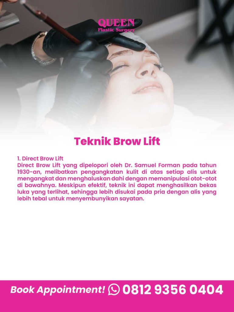 Bosan dibilang kelihatan lelah atau cemberut? 🤨 Ubah penampilan Anda dengan solusi Brow Lift terbaik dari Dr. Heri Noviana, Sp.BP-RE, M. Ked. Klin di sini.