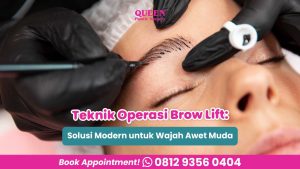 Jangan salah pilih operasi pengencangan dahi! 🛑 Ketahui perbedaan mutlak Endoskopi vs Direct Brow Lift dari ahlinya, Dr. Heri Noviana, Sp.BP-RE, M. Ked. Klin