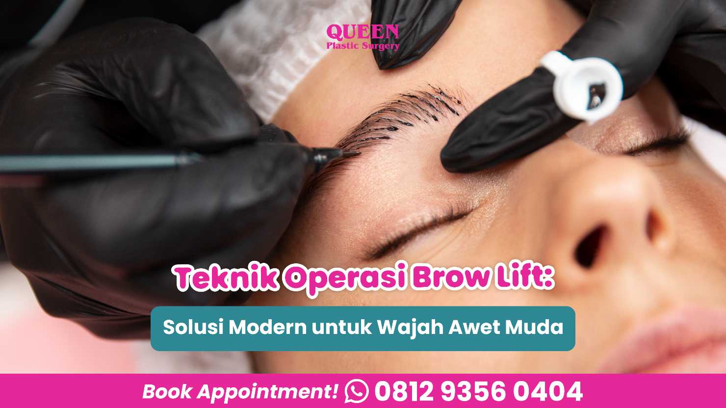 Jangan salah pilih operasi pengencangan dahi! 🛑 Ketahui perbedaan mutlak Endoskopi vs Direct Brow Lift dari ahlinya, Dr. Heri Noviana, Sp.BP-RE, M. Ked. Klin