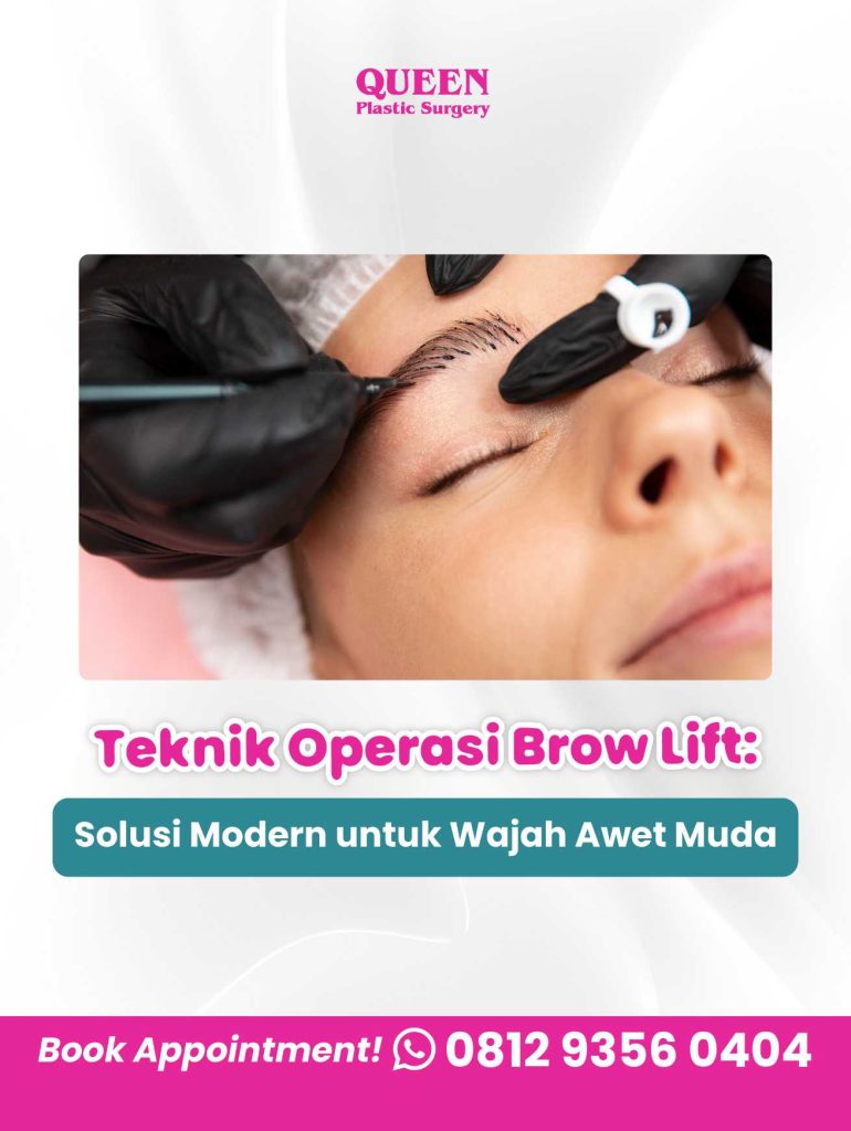 Rahasia tatapan segar dan mata 'open' tanpa efek wajah kaku. ✨ Yuk, intip perbandingan dua teknik Brow Lift modern dari Dr. Heri Noviana, Sp.BP-RE, M. Ked. Klin!