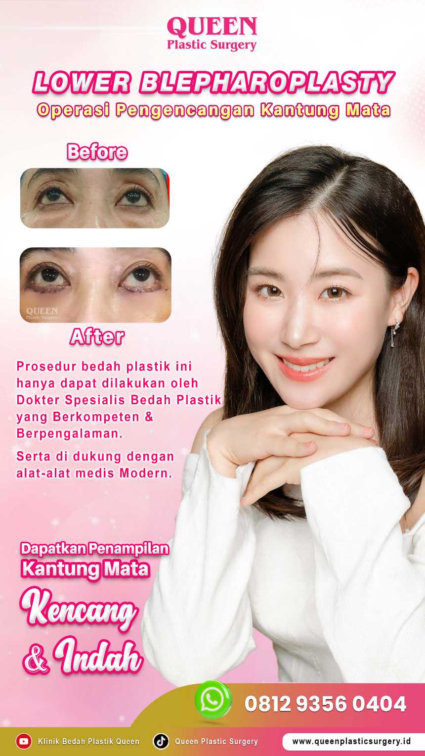 Rahasia hasil Blefaroplasti yang tahan lama ada di sini. ✨ Temukan kenapa kantung mata bisa muncul lagi dan cara mengatasinya
