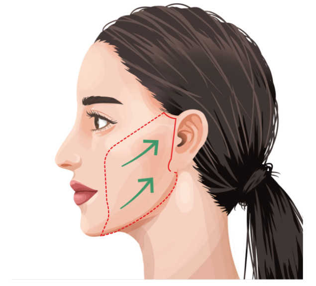 SMAS vs Deep Plane Facelift: Mana yang hasilnya paling tahan lama seumur hidup? 💎 Cari tahu rekomendasi terbaik Dr. Heri Noviana, Sp.BP-RE, M. Ked. Klin di artikel ini.