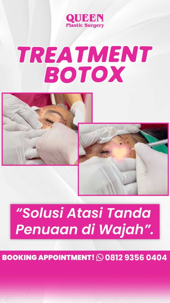 Solusi cepat wajah tampak lebih bahagia & awet muda. 😊 Botox garis marionette jawabannya! Konsultasi dengan dr. Heri Noviana.