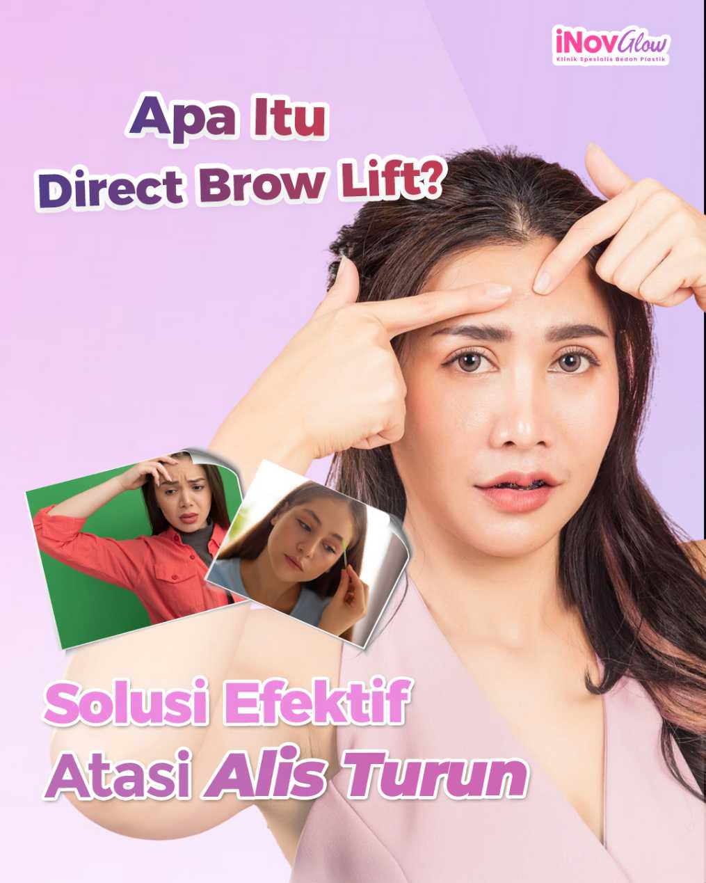 Wajah tampak 'naik' dan segar seketika? Cek bagaimana Brow Lift bekerja untuk estetika wajah Anda di sini!