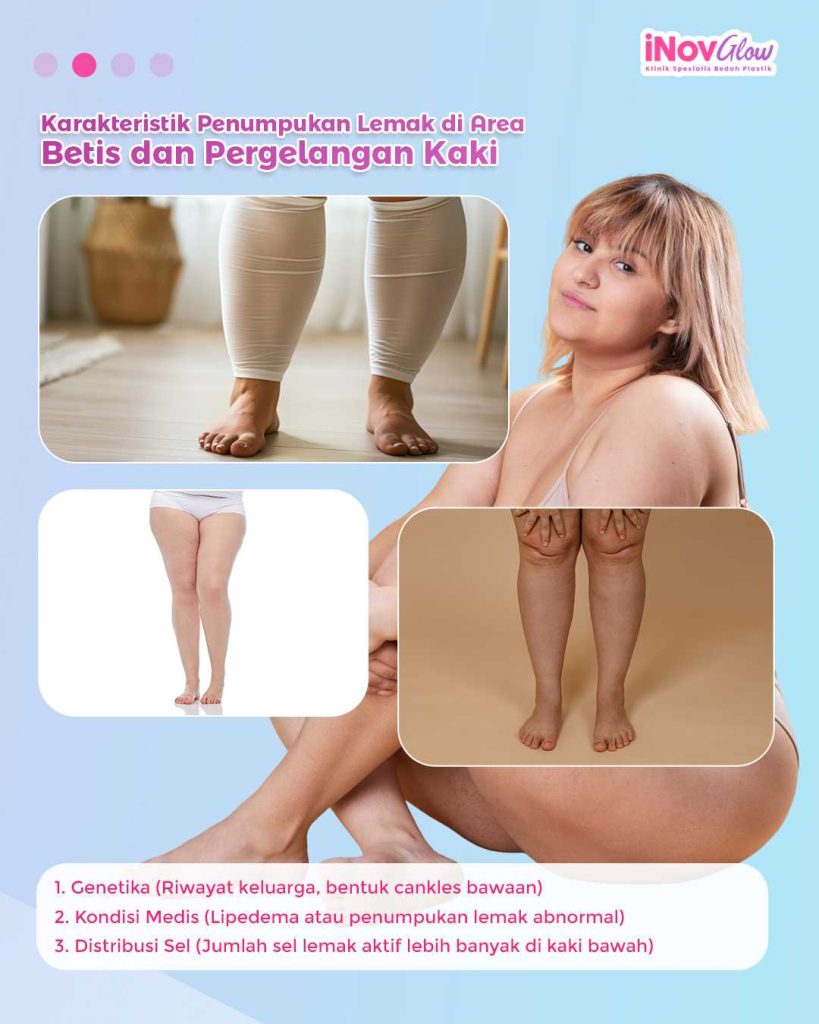 Liposuction betis vs olahraga berat: Mana yang paling efektif melenyapkan lemak lokal? 🧐 Temukan jawabannya dari Dr. Heri Noviana!