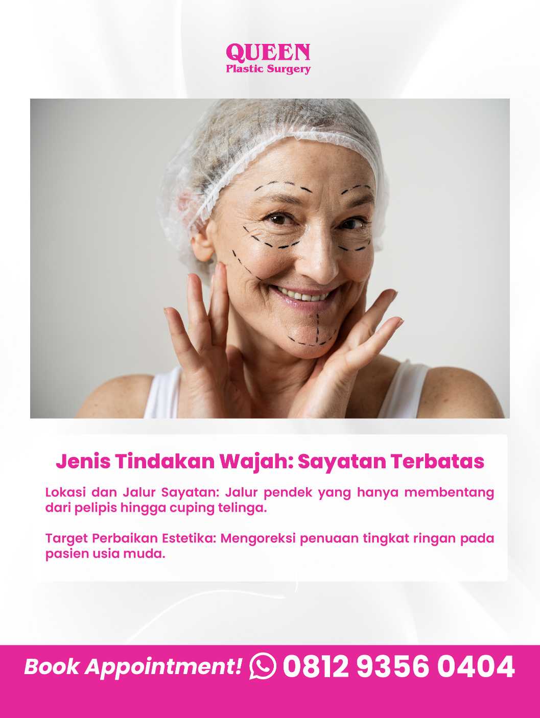 Solusi jitu menyingkirkan kerutan dalam dan kulit kendur di area leher (turkey neck). ✨ Intip ulasan lengkap Dr. Heri Noviana di sini!