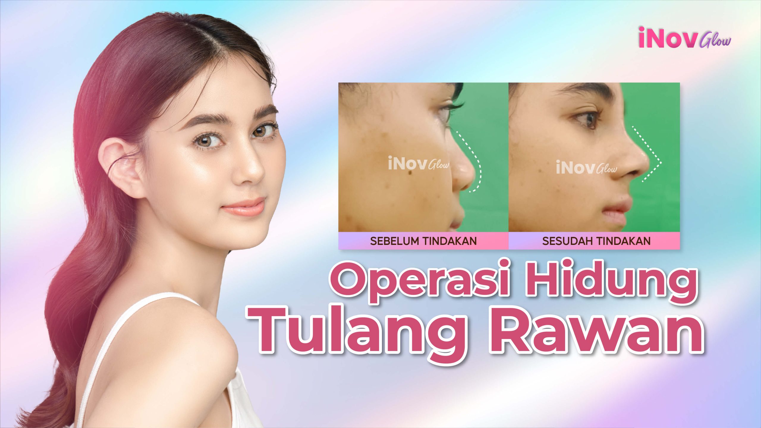 Jangan asal pilih pasang implan hidung instan sebelum tahu kapan tubuh Anda justru WAJIB pakai cangkok tulang rawan dalam Rhinoplasty! 🛑 Cek ulasan Dr. Heri Noviana.