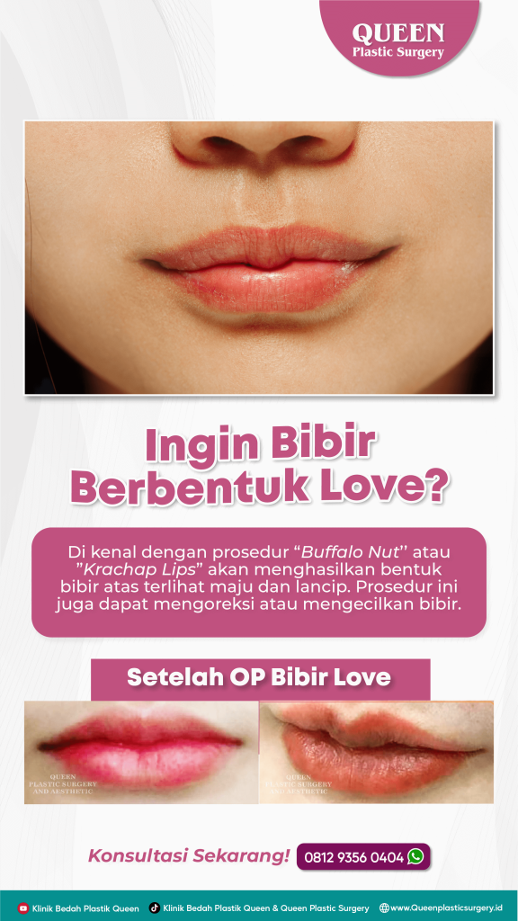 Mengapa silikon bibir cair di bibir TIDAK BISA hancur sendiri dan wajib diangkat secara bedah? 📐 Pahami penjelasan ilmiah Dr. Heri Noviana.