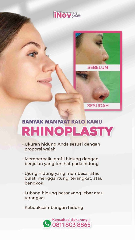 Mau bengkak Rhinoplasty susut dalam hitungan hari? 👃 Ini satu jenis asupan ajaib yang direkomendasikan Dr. Heri Noviana agar luka cepat kering!