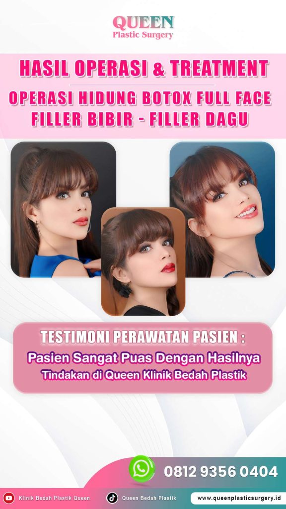 Tanpa drama bahan kosmetik ditolak oleh jaringan bibir! 🙅♀️ Pelajari panduan lengkap memilih Filler vs Implan dari Dr. Heri Noviana sekarang.