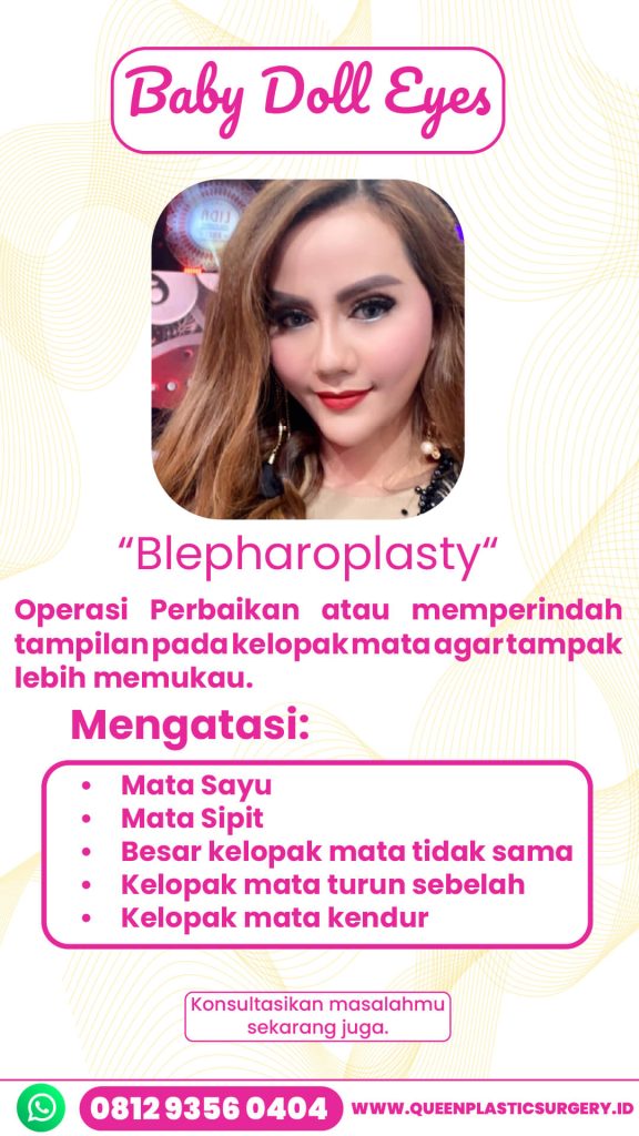 Rahasia tatapan mata segar, tegas, dan awet muda terungkap! Buka artikel untuk fakta lengkapnya mengenai blepharoplasty!